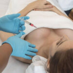 A doctor preforming a breast reduction in Sydney